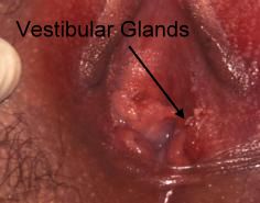 Vestibular Glands